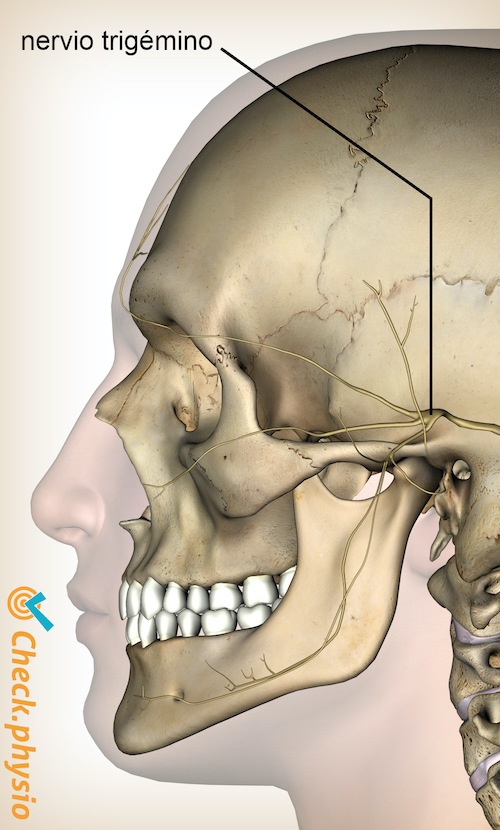 cabeza cefalea cervicogénica cgh nervio trigémino