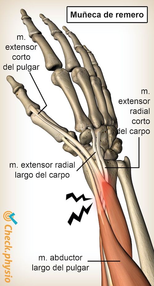 brazo muñeca de remero anatomía extensor radial corto del carpo abductor pollicis longus