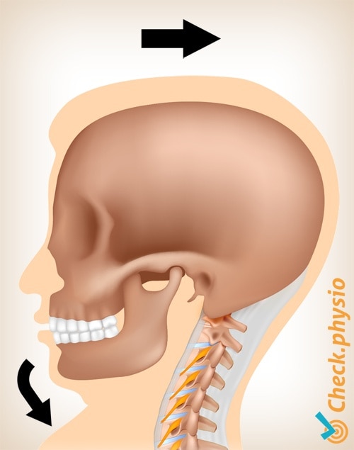 dolor de latigazo cervical movimiento 1