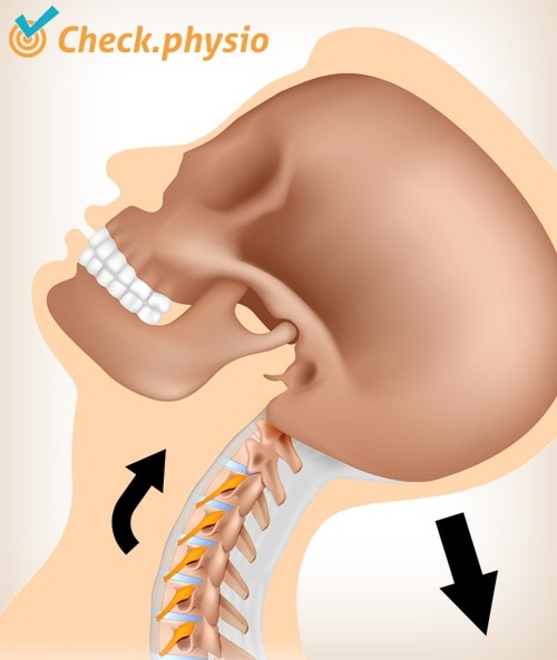 dolor de latigazo cervical movimiento 3