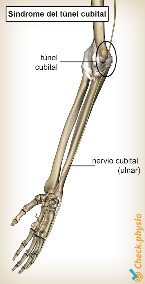 brazo túnel cubital nervio cubital