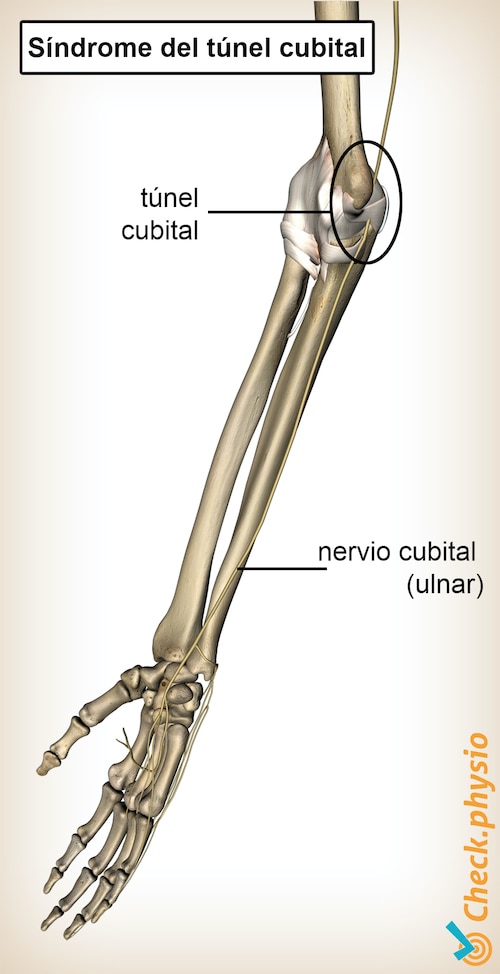 brazo túnel cubital nervio cubital